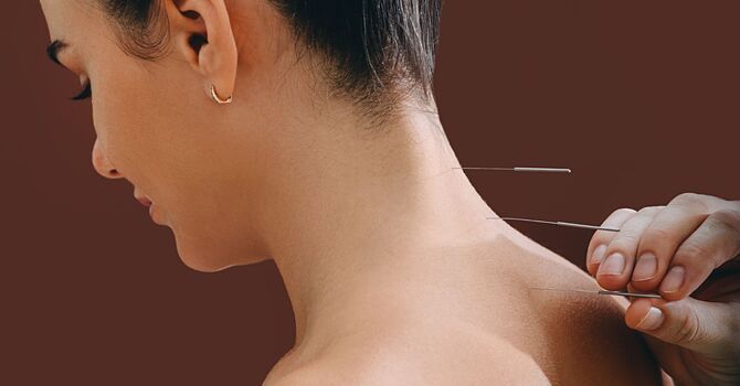 Acupuncture for Sleep Problems